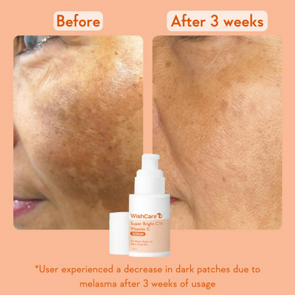 Wishcare Super Bright C16 Vitamin C Face Serum