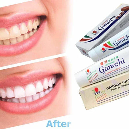 DXN GAI TOOTHPASTE CONTAINS GANODERMA (150 GM)