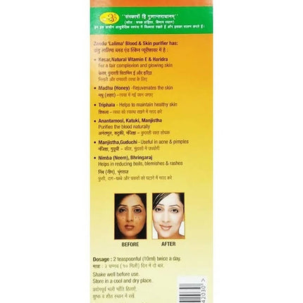 Zandu Lalima Blood And Skin Purifier Syrup