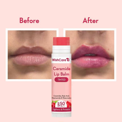 Wishcare Ceramide Lip Balm with SPF50 PA+++ - Tinted - Brightening Balm for Dark Lips with Kojic Acid & Niacinamide
