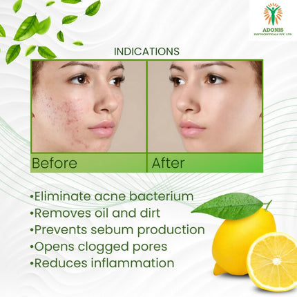 Adonis DS Acne Facewash
