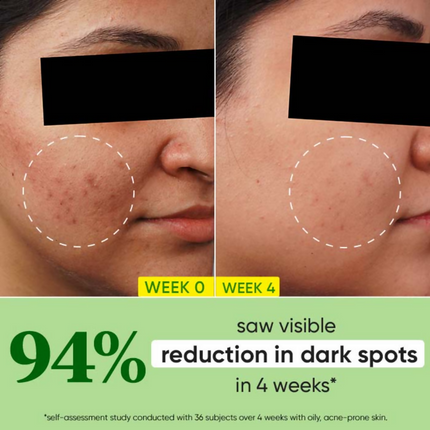 Dot & Key 10% Niacinamide Cica Face Serum