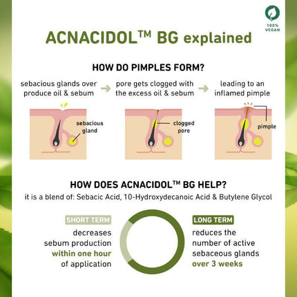 Plum Green Tea & 3% Zinc Complex Face Serum with Acnacidol BG - Fights Acne, Pimples & Controls Oil