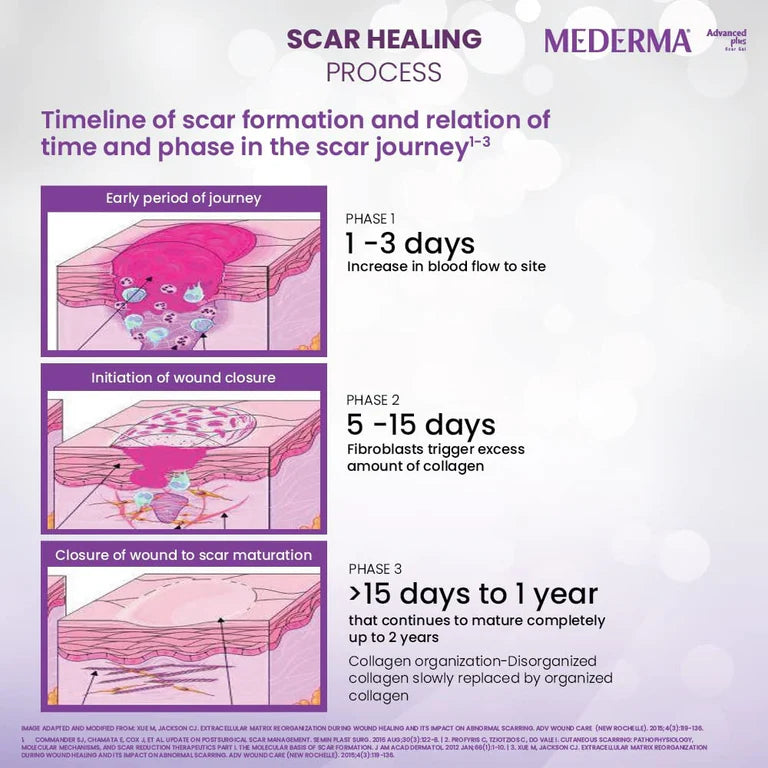 Mederma Advanced Plus Scar Gel
