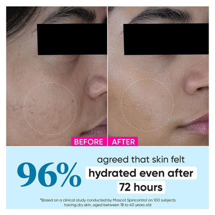Dot & Key 72 Hr Hydrating Probiotic Face Gel With With Hyaluronic Acid, Kombucha & Rice Water