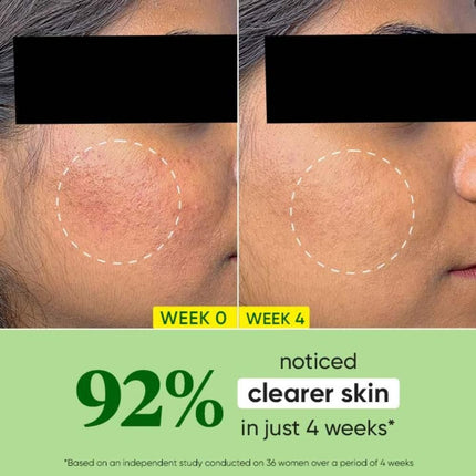 Dot & Key CICA +Niacinamide Oil Free Moisturizer