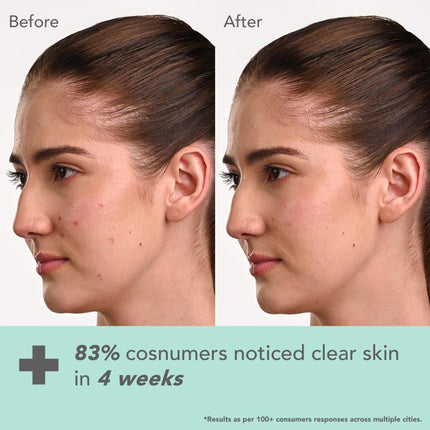 Lotus DermaBotanics Kojic Acid + Multi Berry Ampoule Crème, pH5.5, For Sensitive Skin